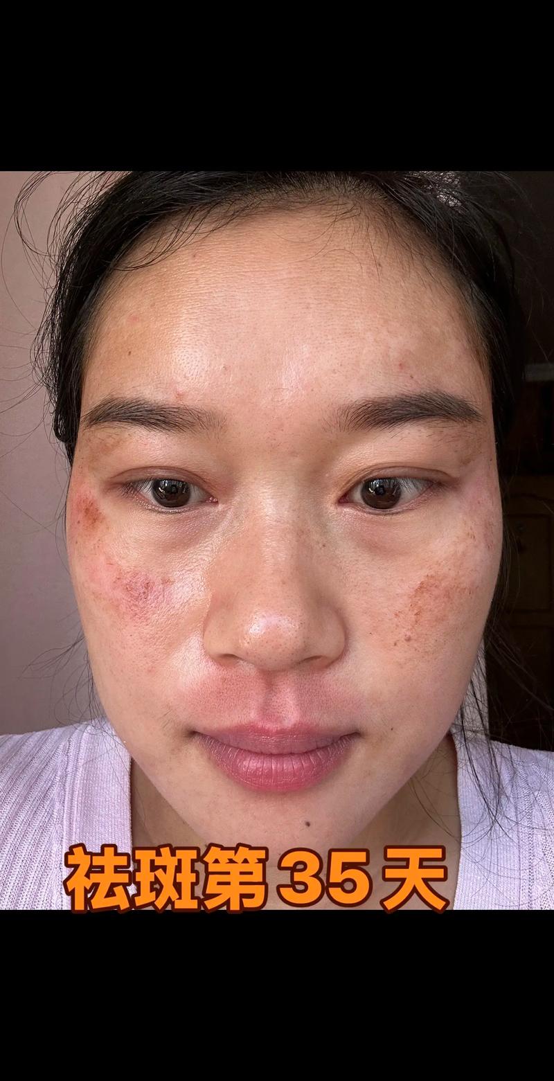 海门皮肤管理：以科技之力焕新肌肤